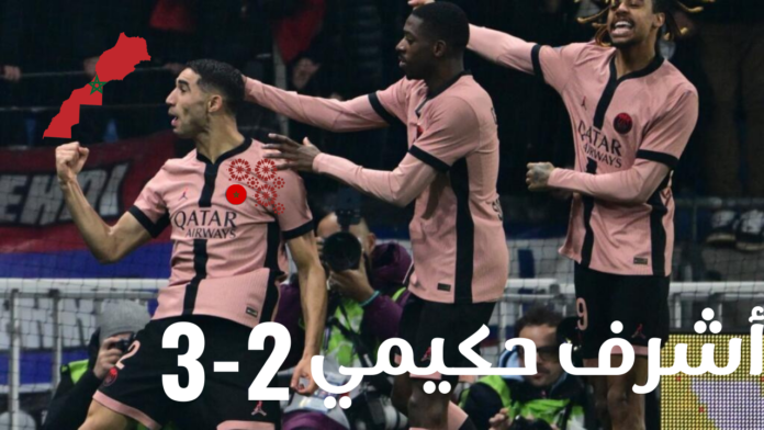 الدوري الفرنسي